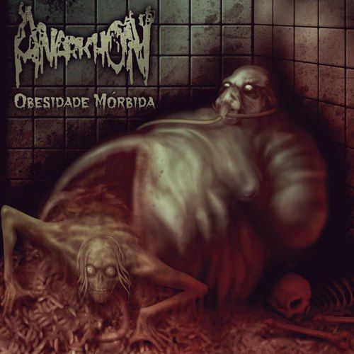 ANARKHON - Obesidade Mórbida